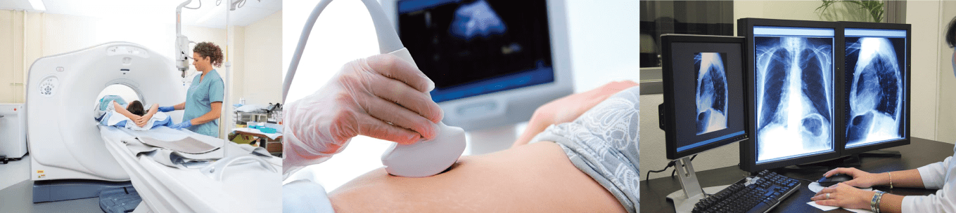 esonancia Magnética (MRI)